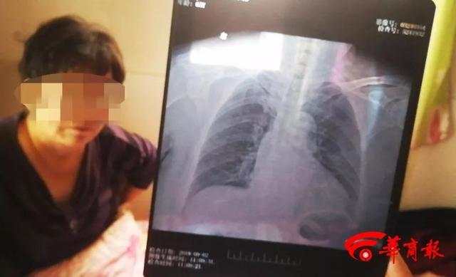 受伤的胡老太 受伤的胡老太