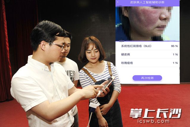 图为湘雅二医院皮肤科医生在演示如何通过拍图识病。  长沙晚报通讯员 王建新 摄