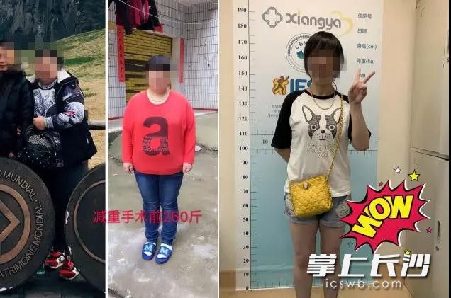 张女士减重瘦身前后对比图。 张女士减重瘦身前后对比图。