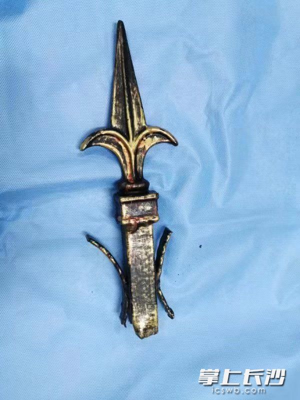 医生通过手术顺利帮刘小臻(化名)取出了刺入体内的防盗刺。 医院供图 医生通过手术顺利帮刘小臻(化名)取出了刺入体内的防盗刺。 医院供图