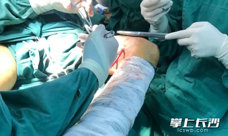 医生紧张开展手术。  医院供图