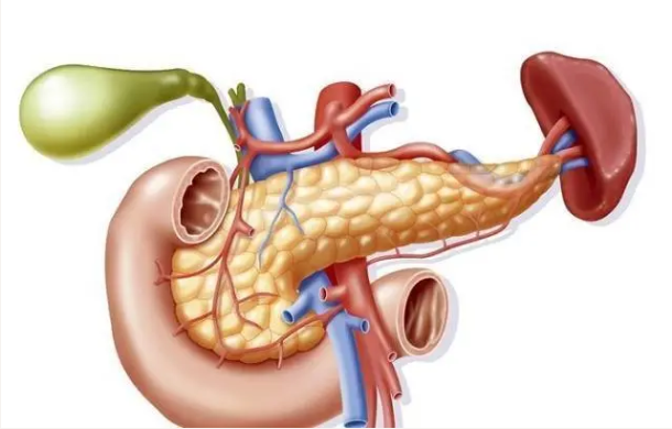 胰腺炎是胰腺及周围组织被胰腺分泌的消化酶所消化而引起的急性化学性炎症。