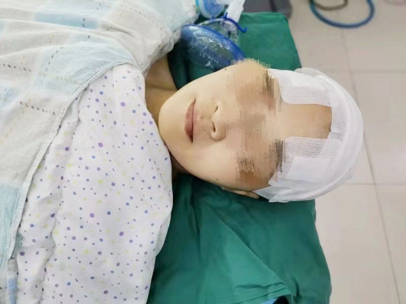 术后复查,患者头颅CT确定电极置入与计划靶点位置一致,手术获得成功。 术后复查,患者头颅CT确定电极置入与计划靶点位置一致,手术获得成功。