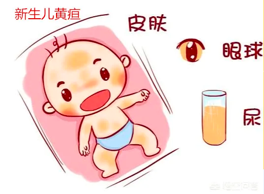 蓝光治疗是新生儿黄疸最简单、便捷、有效的措施。