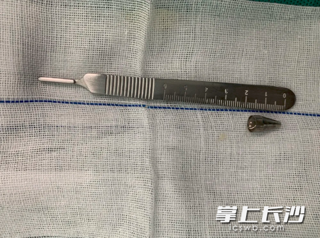 术中取出一个长约2厘米的笔帽。