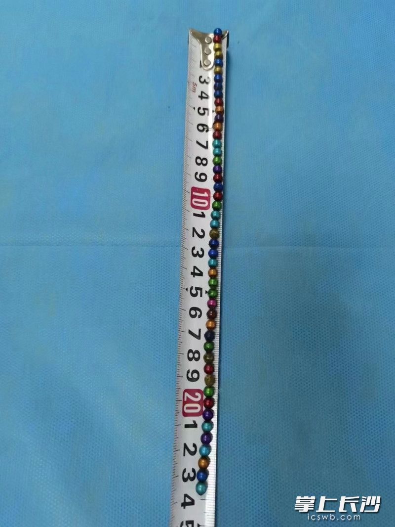 医生通过胃镜取出的48颗巴克球磁珠。