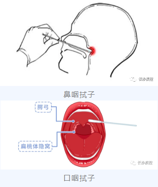 鼻咽拭子和口咽拭子。