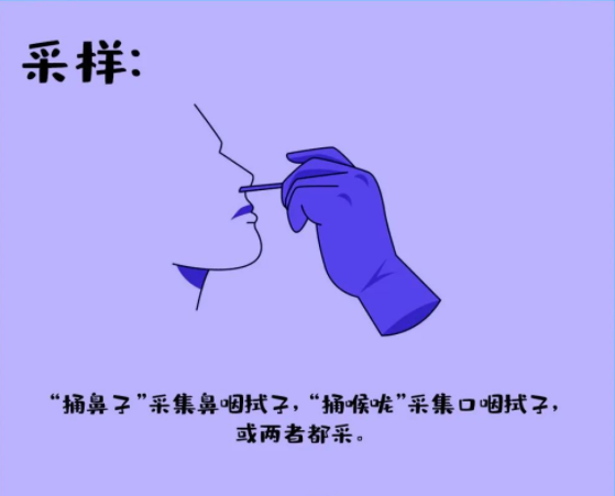 采样：捅鼻子采集鼻咽拭子，捅喉咙采集口咽拭子，或两者都采集。