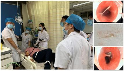湘雅三医院医务人员在紧急救治被鱼刺划破食管的患者。由医院供图