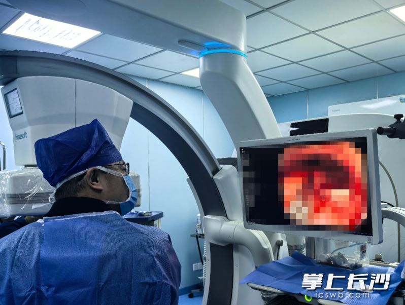 湖南省人民医院消化内科学科主任刘鹏教授带领团队，为患者实施急诊胃镜下异物取出术。 均为长沙晚报通讯员黎秀兰、邹颢宇供图