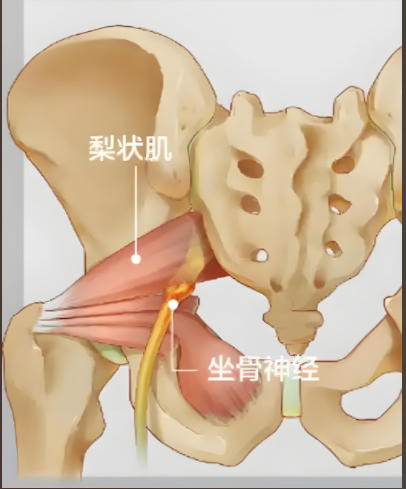 梨状肌与坐骨神经示意图。