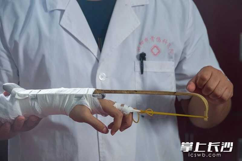 江林研发自制的竹弓牵引器械，已申请国家专利，对于手指骨折患者具有良好的康复锻炼的辅助作用。李锋 摄