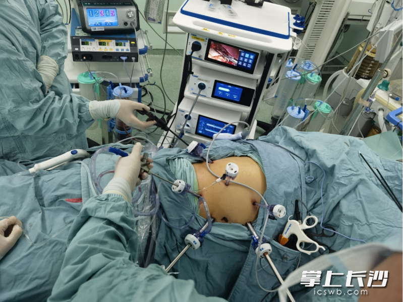 只在肚子上打几个小孔，精准切除肿瘤。