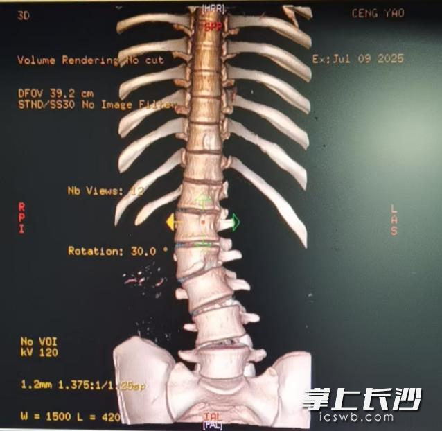 患者术前的影像检查。均为通讯员供图