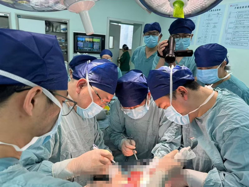 肝胆外科团队为患者做手术。