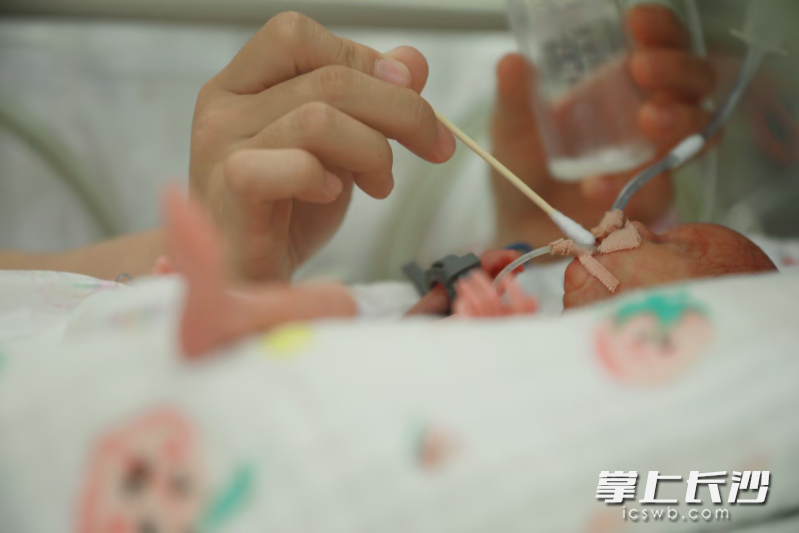 三位“小天使”提前降临，出生时胎龄仅26周，其中最轻的宝宝体重仅750克。