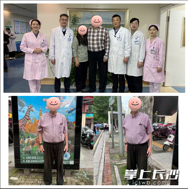美国患者实施减重代谢手术前后的对比。均为通讯员供图