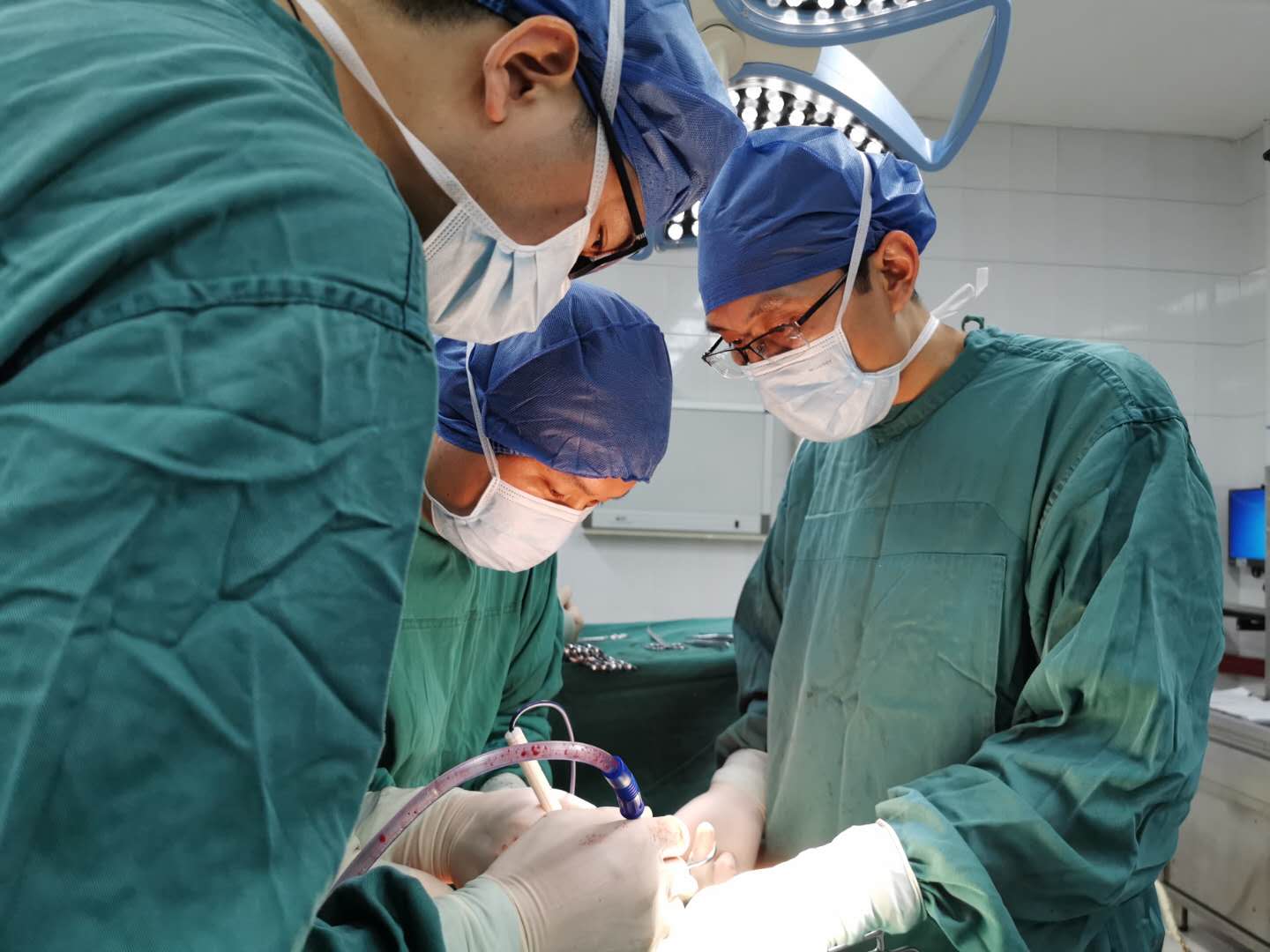 杨科及手术团队为患者实施阴茎部分切除术。长沙晚报通讯员 胡薇华 陈昊 张丽 供图