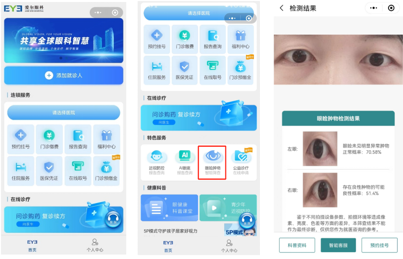 爱尔眼科互联网医院小程序“眼睑肿物智能筛查”。