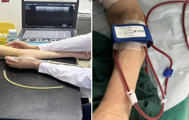 术前反复评估(左),术后第一次使用(右)。 术前反复评估(左),术后第一次使用(右)。